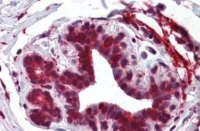 Immunohistochemistry-Paraffin: ELOVL5 Antibody [NBP3-14304] - ELOVL5 antibody IHC of human breast. Immunohistochemistry of formalin-fixed, paraffin-embedded tissue after heat-induced antigen retrieval.